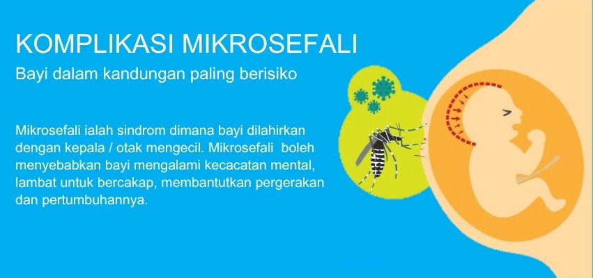 Komplikasi Mikrosefali